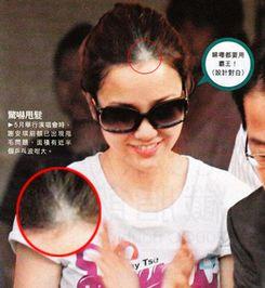 盘点脱发严重的女明星  第2张